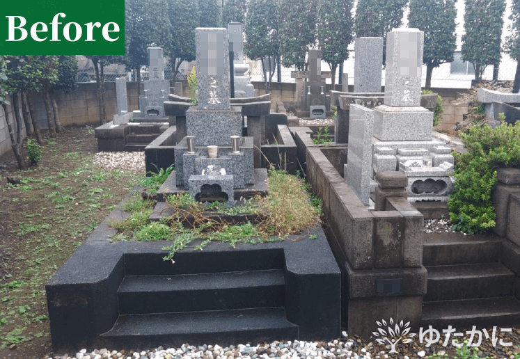 埼玉県の柏木佳子様-before